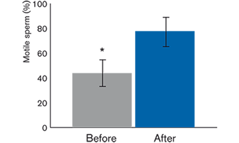 Sperm Preparation - Vitrolife