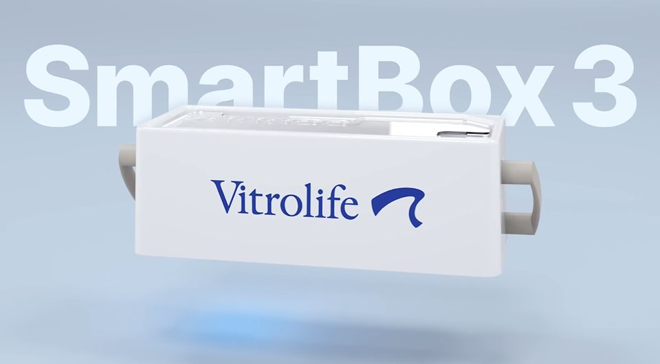 smartbox